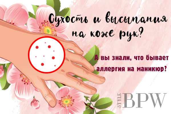 Фото Сухость и высыпания на коже рук? А вы знали, что бывает аллергия на маникюр? из категории Здоровье ногтей и их прекрасных обладательниц. Факты, лайфхаки, советы-всё здесь